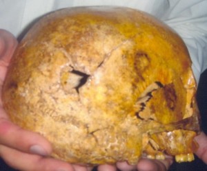 From MI CAMINO Facebook page, skull of the martyr showing the coup de grâce bullet hole